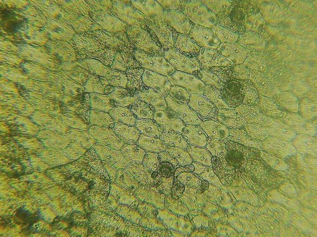verhnij-sloj-jepidermisa-lista-pod-mikroskopom.jpg