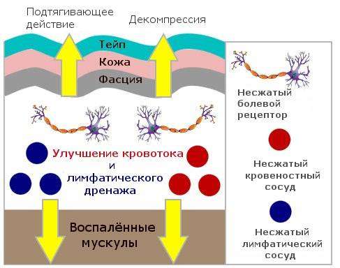 plastyr-ot-boli-v-spine-1.jpg