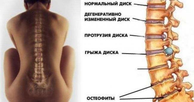 princy-deystviya-ortopedicheskih-stul-ev-dlya-osanki-12.jpg