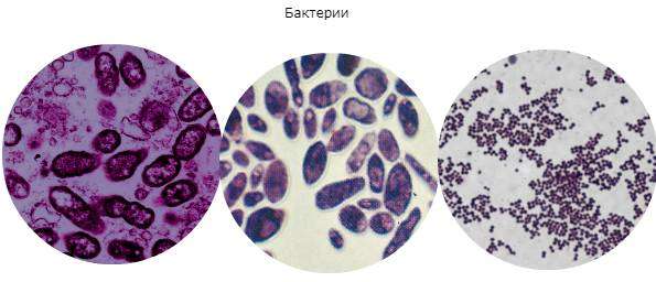 bakterii-varasheny-v-agare.jpg